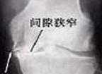 典型病例